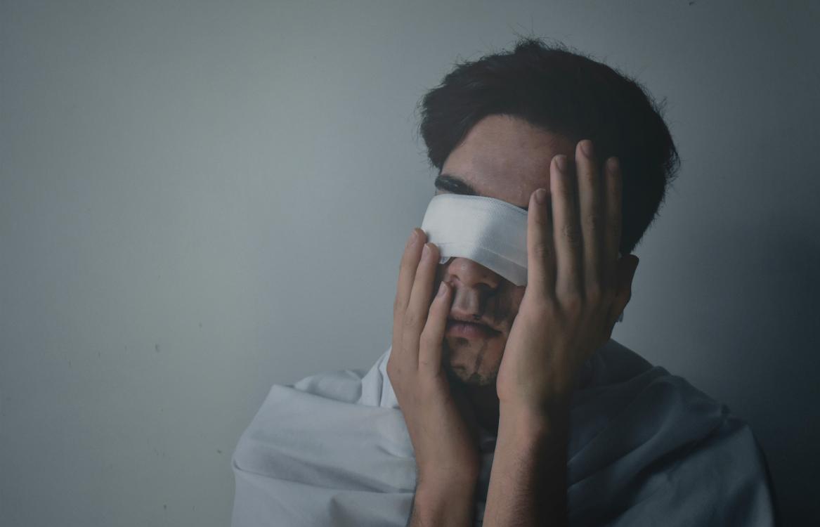 Cycling Concussions: What To Do